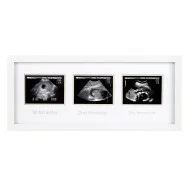 Pearhead - Rama foto pentru ecografii