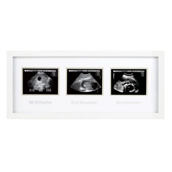 Pearhead - Rama foto pentru ecografii krbaby.ro