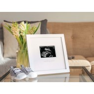 Pearhead - Rama foto pentru pastrarea ecografiei