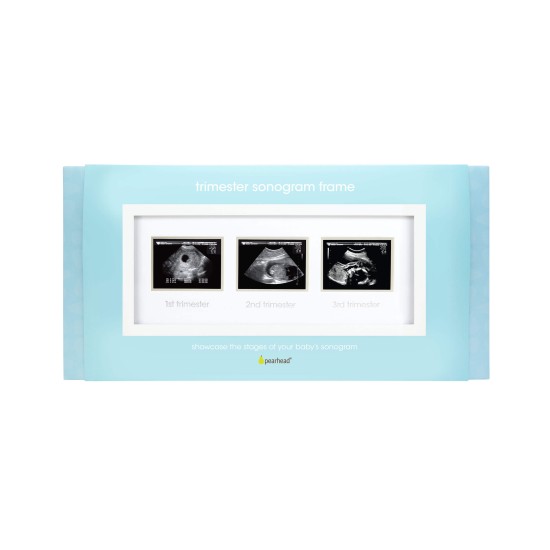 Pearhead - Rama foto pentru ecografii krbaby.ro
