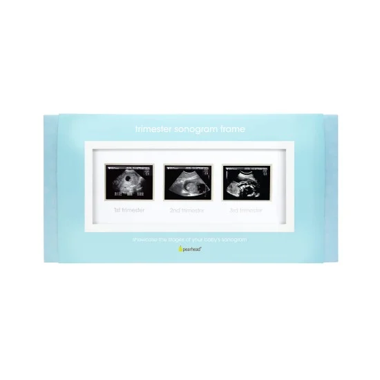 Pearhead - Rama foto pentru ecografii krbaby.ro